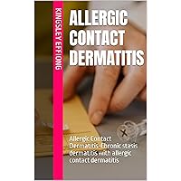 Allergic Contact Dermatitis: Allergic Contact Dermatitis-Chronic stasis dermatitis with allergic contact dermatitis