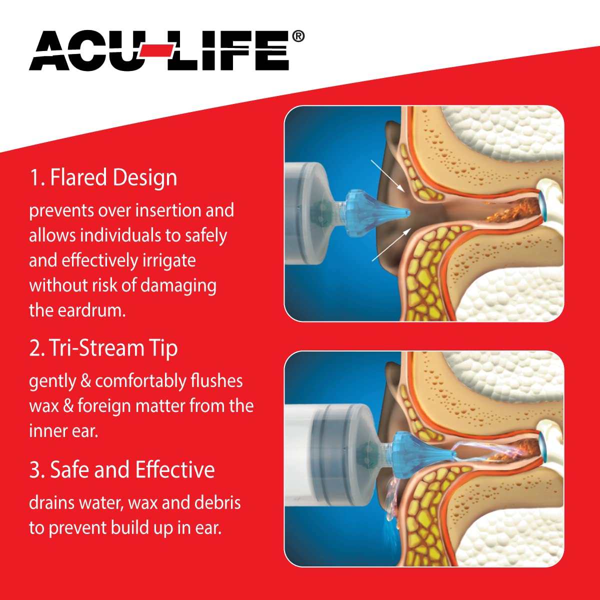 Acu-Life Ear Irrigator, Soft Tri-Steam Fit with Flarred Design for Comfort, Includes Basin, Ear Syringe and Easy Squeeze Bottle