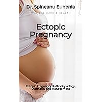 Ectopic Pregnancy: Pathophysiology, Diagnosis, and Management Ectopic Pregnancy: Pathophysiology, Diagnosis, and Management Kindle Paperback