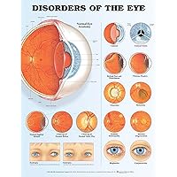 Disorders of The Eye Anatomical Chart