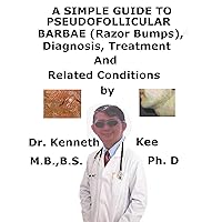 A Simple Guide To Pseudofolliculitis barbae (Razor Bumps), Diagnosis, Treatment And Related Conditions A Simple Guide To Pseudofolliculitis barbae (Razor Bumps), Diagnosis, Treatment And Related Conditions Kindle