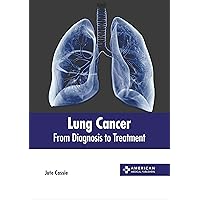 Lung Cancer: From Diagnosis to Treatment