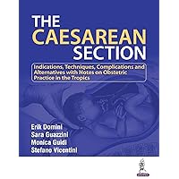 The Caesarean Section The Caesarean Section Kindle Paperback