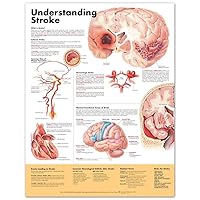 Understanding Stroke Anatomical Chart