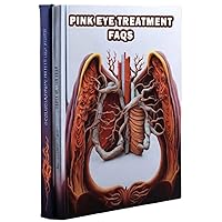 Pink Eye Treatment FAQs: Learn about frequently asked questions regarding pink eye treatment, from at-home remedies to medical interventions. Discover ways to manage this common eye condition. Pink Eye Treatment FAQs: Learn about frequently asked questions regarding pink eye treatment, from at-home remedies to medical interventions. Discover ways to manage this common eye condition. Paperback