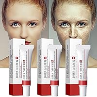 Dark Spot Remover for Face, 3PCS Dark Spot Corrector Cream, Enriching Powerful Ingredients, For All Skin Tones - Melasma, Freckle, Sun Spot Remover & Blemish Reducer, 2.1 FL OZ