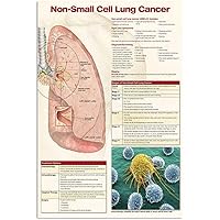Lung Cancer Knowledge Metal Tin Signs Vintage Non small Cell Lung Cancer Infographic Posters Doctor's Office Guidelines Plaques Office Hospital Room Home Wall Decor 8x12 Inches