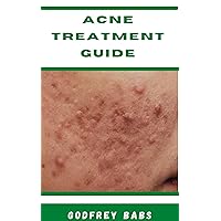 Acne Treatment Guide : Manage acne with ease Acne Treatment Guide : Manage acne with ease Kindle Paperback