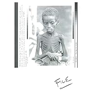Vintage photo of The face of hunger, malnourished Somali child.