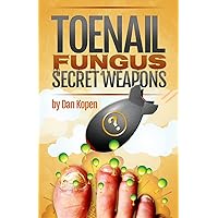 Toenail Fungus Secret Weapons: Uncover over 14 toenail fungus treatments that you can combine to clear your toe nails in under 45 days! Toenail Fungus Secret Weapons: Uncover over 14 toenail fungus treatments that you can combine to clear your toe nails in under 45 days! Paperback
