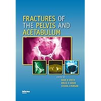 Fractures of the Pelvis and Acetabulum Fractures of the Pelvis and Acetabulum Hardcover