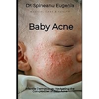 Infantile Dermatology: Navigating the Complexities of Baby Acne (Medical care and health)
