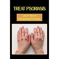 Treat Psoriasis: Learn About Eliminating Psoriasis