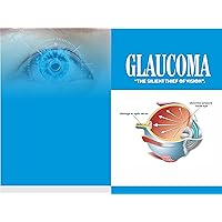 Glaucoma: The Silent Thief of Vision Glaucoma: The Silent Thief of Vision Kindle