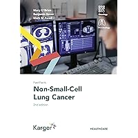 Fast Facts: Non-Small-Cell Lung Cancer Fast Facts: Non-Small-Cell Lung Cancer Kindle Paperback