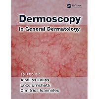 Dermoscopy in General Dermatology Dermoscopy in General Dermatology Kindle Hardcover