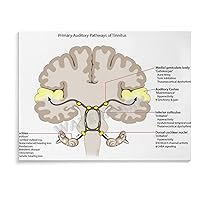 Primary Auditory Pathways of Tinnitus Poster Poster of The Otolaryngology Room of The Hospital Clinic Canvas Painting Posters And Prints Wall Art Pictures for Living Room Bedroom Decor 20x16inch(51x4