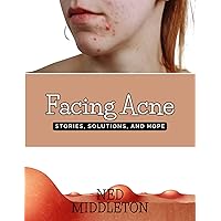 Facing Acne: Stories, Solutions, and Hope Facing Acne: Stories, Solutions, and Hope Kindle Paperback
