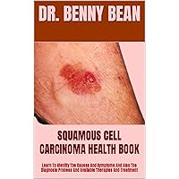SQUAMOUS CELL CARCINOMA HEALTH BOOK : Learn To Identify The Causes And Symptoms And Also The Diagnosis Process And Available Therapies And Treatment SQUAMOUS CELL CARCINOMA HEALTH BOOK : Learn To Identify The Causes And Symptoms And Also The Diagnosis Process And Available Therapies And Treatment Kindle Paperback