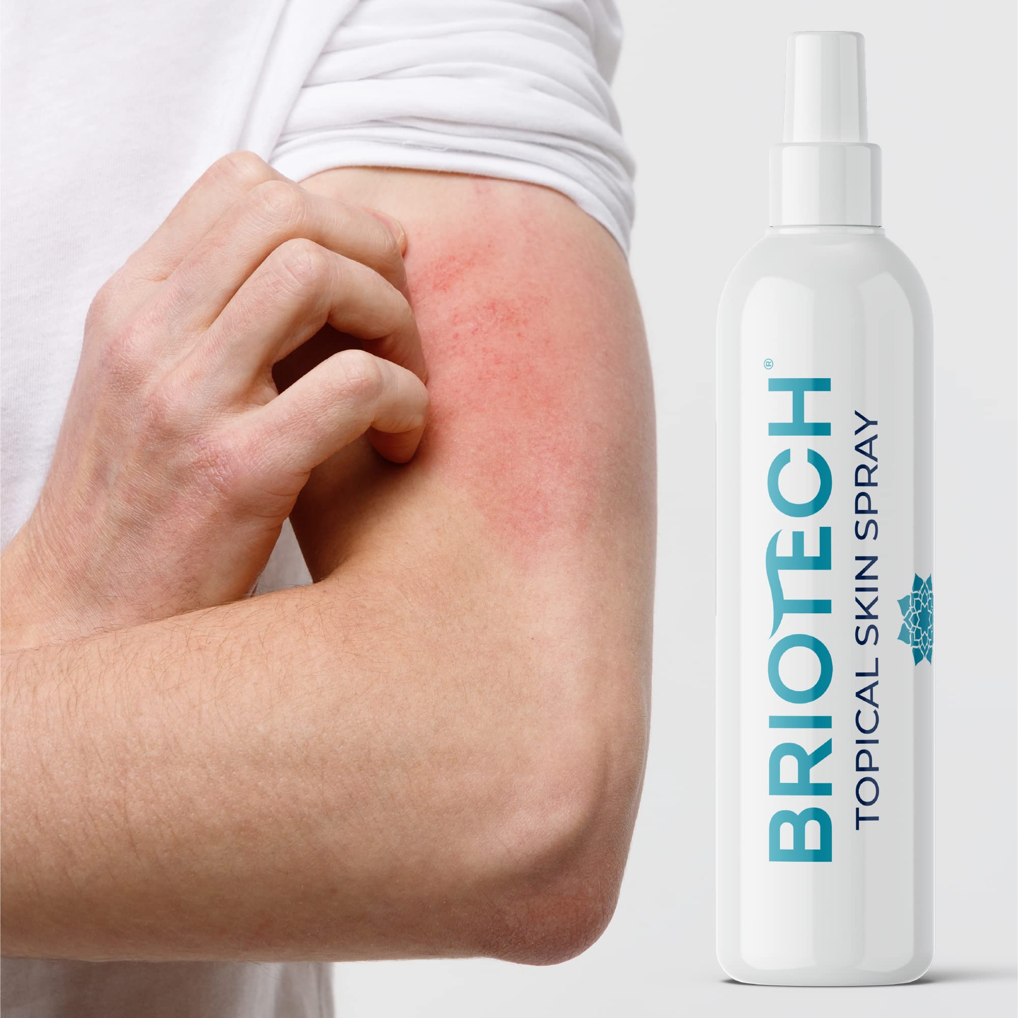 BRIOTECH Topical Skin Spray, Pure Hypochlorous Acid Spray, Face & Body HOCl Mist, Support Irritations, Soothe Redness, Eyelid Eyelash Bumps, Dry Skin & Scalp, Athletic Itch, Toenail Cleanser