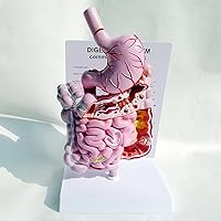 1/2 Natural Size Colorectal Disease Model, Intuitive Clear Human Digestive System Anatomical Model, Shows Various Problems of The Colon and Rectum