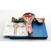 Uterus and Ovary Model Female Reproductive (Organ Model Human Anatomy Replica Show Uterus Ovary Vagina)