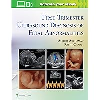 First Trimester Ultrasound Diagnosis of Fetal Abnormalities First Trimester Ultrasound Diagnosis of Fetal Abnormalities Hardcover Kindle