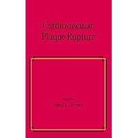 Cardiovascular Plaque Rupture (Fundamental and Clinical Cardiology Book 45) Cardiovascular Plaque Rupture (Fundamental and Clinical Cardiology Book 45) Kindle Hardcover