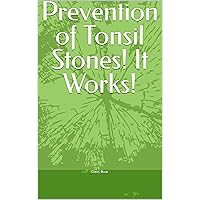 Prevention of Tonsil Stones! It Works!