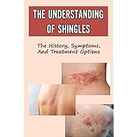 The Understanding Of Shingles: The History, Symptoms, And Treatment Options