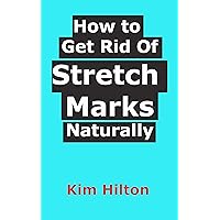 How to Get Rid Of Stretch Marks Naturally How to Get Rid Of Stretch Marks Naturally Kindle Paperback
