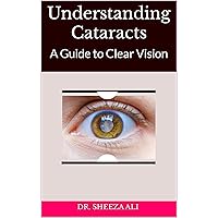 Understanding Cataracts: A Guide to Clear Vision Understanding Cataracts: A Guide to Clear Vision Kindle