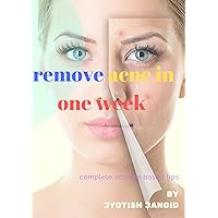 How to Remove acne: in one month How to Remove acne: in one month Kindle