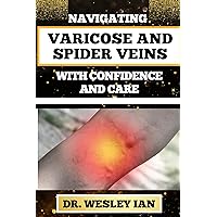 NAVIGATING VARICOSE AND SPIDER VEINS WITH CONFIDENCE AND CARE: Empowering And Mastering Strategies For Healthy Legs And Vibrant Veins Healing NAVIGATING VARICOSE AND SPIDER VEINS WITH CONFIDENCE AND CARE: Empowering And Mastering Strategies For Healthy Legs And Vibrant Veins Healing Kindle Paperback