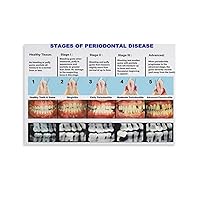 Posters Dentist Poster Vintage Stages of Periodontal Psoter Disease Teeths Poster Canvas Painting Posters And Prints Wall Art Pictures for Living Room Bedroom Decor 24x36inch(60x90cm) Unframe-style