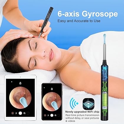 Ear Wax Removal with Camera, Earwax Remover Tool, 1296P FHD Wireless Ear Otoscope with 6 LED Lights, 6 Ear Spoon & 6 Traditional Tools Ear Wax Removal Kit for iPhone, iPad & Android Smart Phone