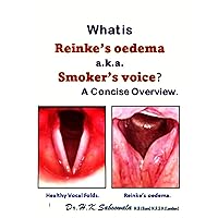 What is Reinke’s oedema/ Smoker’s voice? A Concise Overview. What is Reinke’s oedema/ Smoker’s voice? A Concise Overview. Kindle