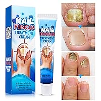 Nail Repair Cream, Effective Toenail Fungus Treatment Fungus Remover Foot Nail Repair Cream Restores The Healthy Appearance of Nails