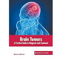 Brain Tumors: A Practical Guide to Diagnosis and Treatment