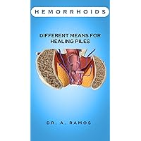 HEMORRHOIDS: DIFFERENT MEANS FOR HEALING PILES HEMORRHOIDS: DIFFERENT MEANS FOR HEALING PILES Kindle Paperback