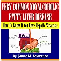 Very Common NonAlcoholic Fatty Liver Disease Very Common NonAlcoholic Fatty Liver Disease Kindle Audible Audiobook Paperback