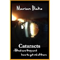 Cataracts: What are they and how to get rid of them? (Your Eyes Book 2) Cataracts: What are they and how to get rid of them? (Your Eyes Book 2) Kindle
