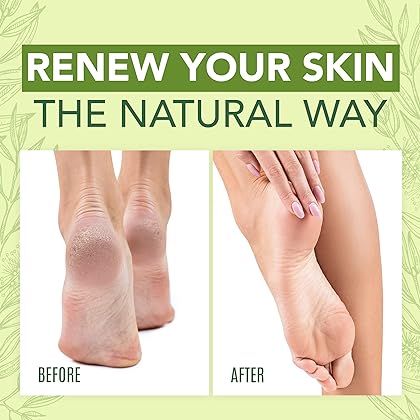 Tea Tree Oil Foot Cream - Instantly Hydrates and Moisturizes Cracked or Callused Feet - Rapid Relief Heel Cream - Natural Treatment Helps & Soothes Irritated Skin & Athletes Foot