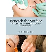 Beneath the Surface: The Complete Guide to Acne Causes and Treatments Beneath the Surface: The Complete Guide to Acne Causes and Treatments Kindle Paperback