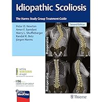 Idiopathic Scoliosis: The Harms Study Group Treatment Guide Idiopathic Scoliosis: The Harms Study Group Treatment Guide Hardcover Kindle