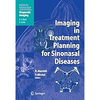Imaging in Treatment Planning for Sinonasal Diseases (Medical Radiology) Imaging in Treatment Planning for Sinonasal Diseases (Medical Radiology) Kindle Hardcover