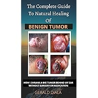 THE COMPLETE GUIDE TO NATURAL HEALING OF BENIGN TUMOR: HOW I SHRANK A BIG TUMOR BEHIND MY EAR WITHOUT SURGERY OR MEDICATION