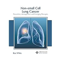 Non-small Cell Lung Cancer: Prevention, Management and Emerging Therapies
