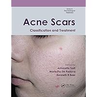 Acne Scars: Classification and Treatment (Series in Dermatological Treatment) Acne Scars: Classification and Treatment (Series in Dermatological Treatment) Paperback