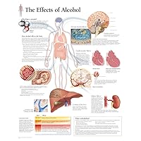 The Effects of Alcohol chart: Laminated Wall Chart